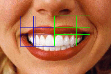 Dr. Levin dental grid on left and right