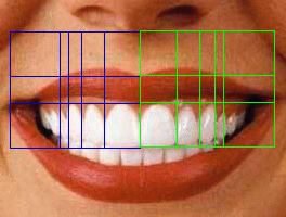 Teeth showing Levin Dental Golden Mean Grid